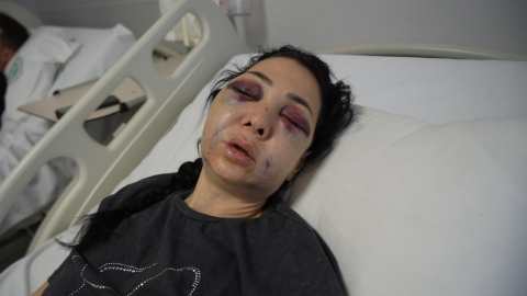Anne ve oğlunun darp edilmesine ilişkin gözaltına alınan 3 şüpheliden 1’i tutuklandı