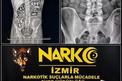 Havalimanında şüpheli yolcuların midesinden uyuşturucu çıktı
