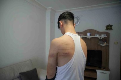 Niğde’de 15 yaşındaki berber çırağına darp iddiası: Önce dövdü, sonra temizlik yaptırdı

